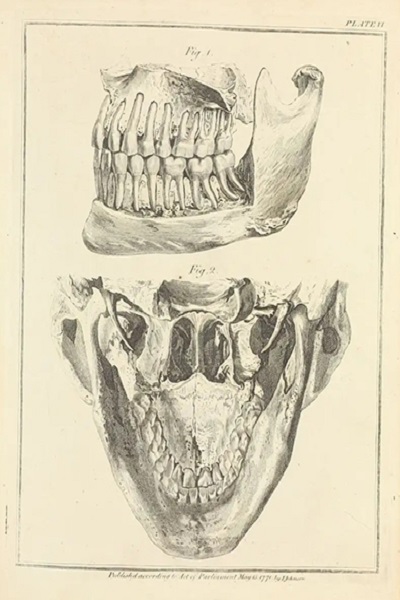 A side view of the Upper and Lower-Jaw