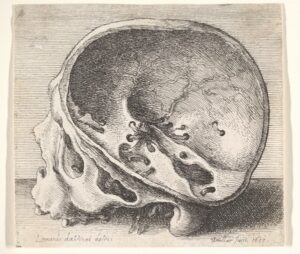 Sectioned skull in profile to left with the left side of the cranium removed